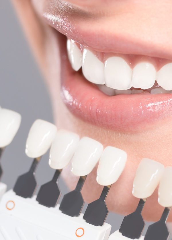 Dente de porcelana pode quebrar?